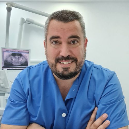 perfil